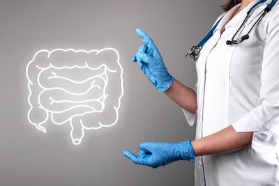 What we know about ‘highly effective’ new bowel cancer treatment