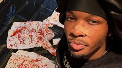 D4vd Faces More Than Murder Charges as Prosecutors Hit Singer With Child Abuse and Mutilation