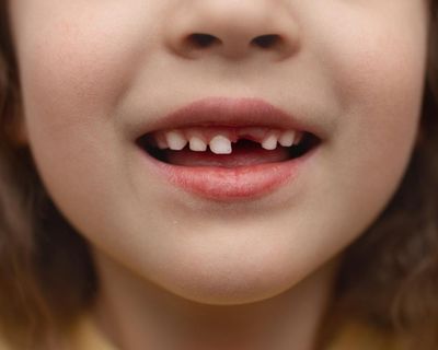 The tooth fairy is ridiculous but kids need rituals. I know I do