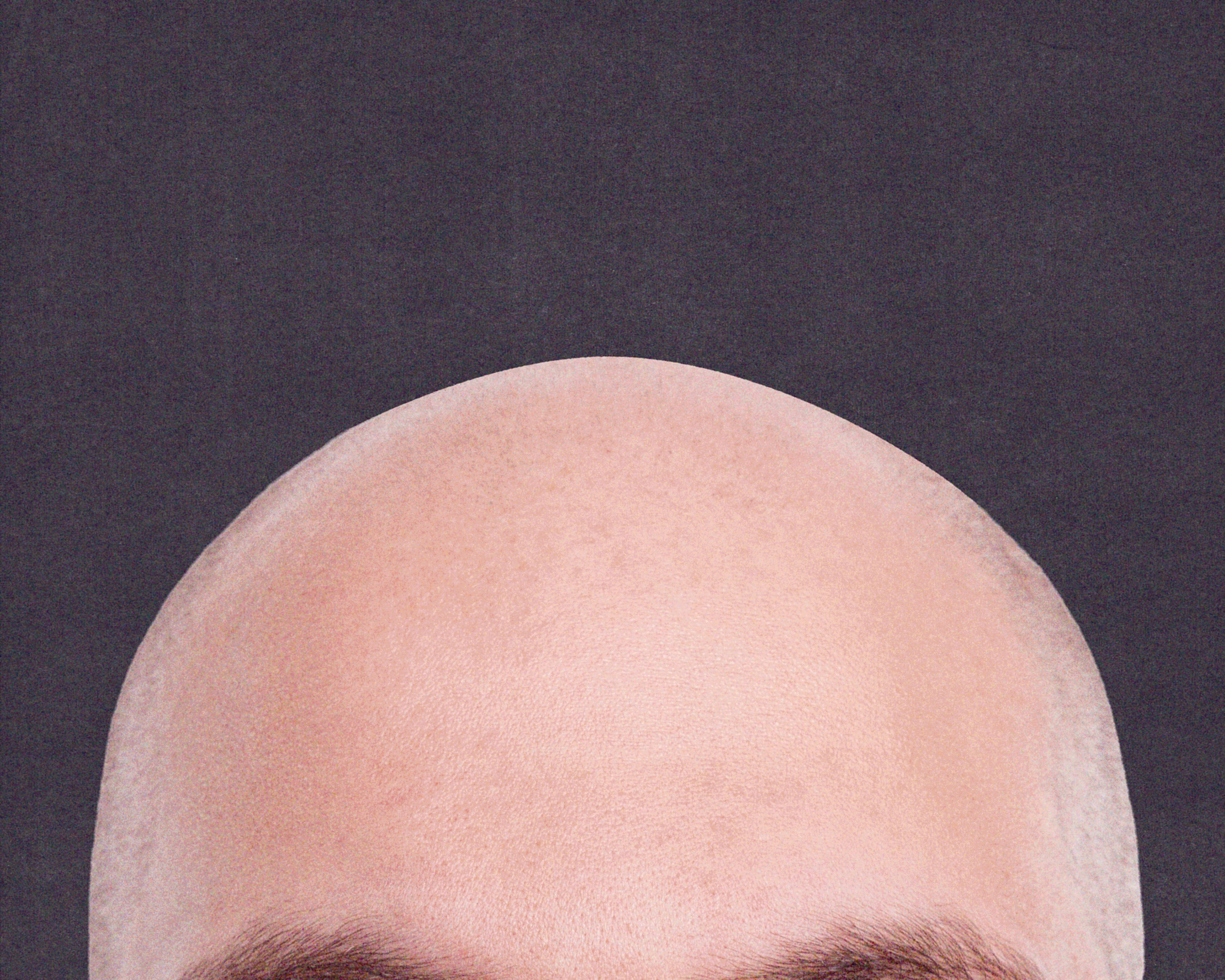 Going bald? There’s a subreddit for that – and it’s weirdly wonderful