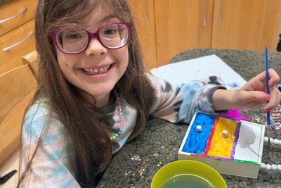 Six-year-old girl has sight restored thanks to life-changing eye gene therapy