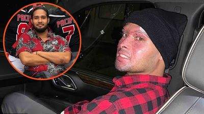 Portland man sues police after getting high on mushrooms and marijuana and burning his fingers off