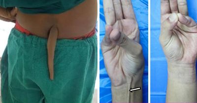 Most Of Us Walk Around Unaware Of These Bizarre Human Body Quirks – Odds Are, You Have Them Too