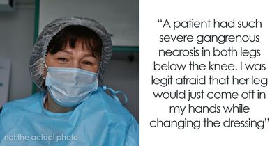45 Medical Professionals Share Patient Stories That Are Definitely Not For The Weak