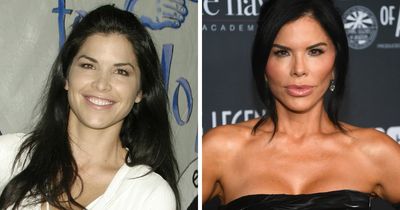 Lauren Sanchez Plastic Surgery Before And After: The “Mar-A-Lago Face” Explained
