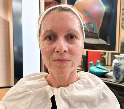 I had a non-surgical facelift – the results really surprised me