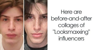 From Bone Smashing To Chin Extensions, These “Looksmaxxing” Changes Are Hard To Ignore
