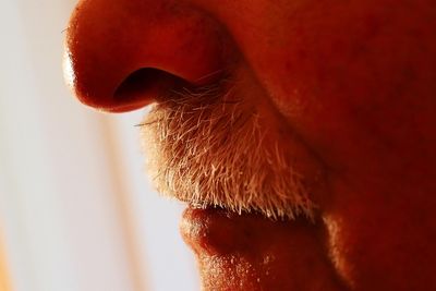 What Frequent Nosebleeds Reveal about Dryness, Local Irritation, and a Possible Clotting Disorder