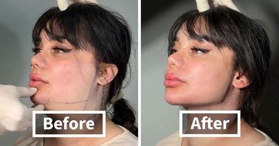 This Plastic Surgery Clinic’s Before-And-After Transformations Have Gone Viral Online (31 Pics)