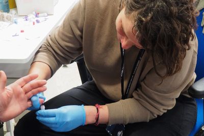 Deadly liver disease, rooted out elsewhere, retains grip on US