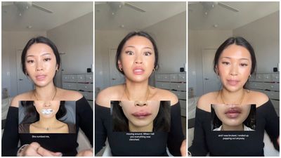 NYC woman gets lip filler for the first time for her birthday and rushes back to the doctor three hours later: ‘I should have never touched my face’