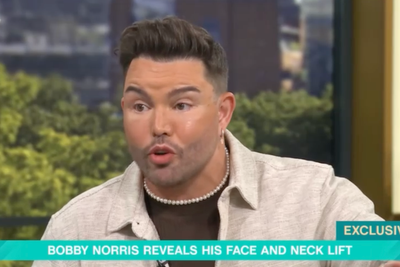 Bobby Norris not ruling out more surgery after facelift at 39