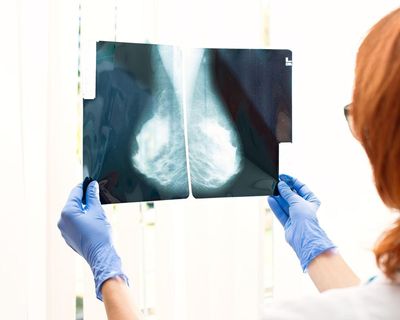 Why routine cancer tests have age limits