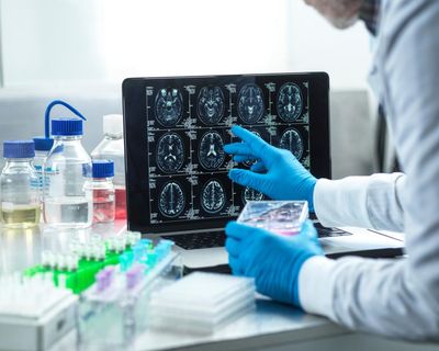 Slow Alzheimer’s diagnoses ‘mean UK patients missing out on experimental treatments’