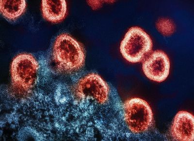 What Is Hantavirus? Symptoms, Causes, Transmission, Prevention & What You Need to Know