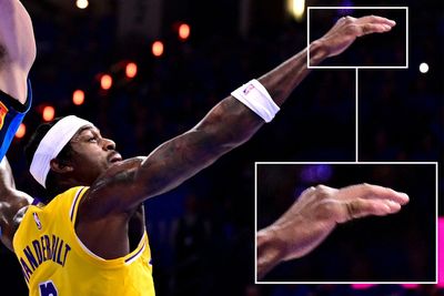 Lakers forward Jarred Vanderbilt suffers gruesome finger bone injury