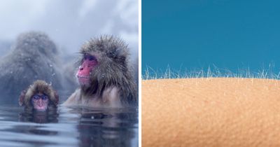 Why Do We Get Goosebumps? The Fascinating Science Behind Your Skin’s Reflex