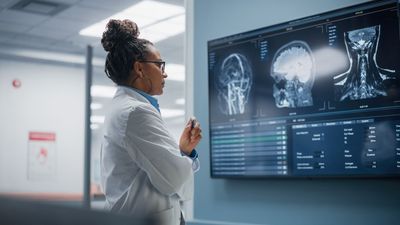 Healthcare Outsourcing Philippines: Why Agentic AI Demands Human Expertise, Not Replacement