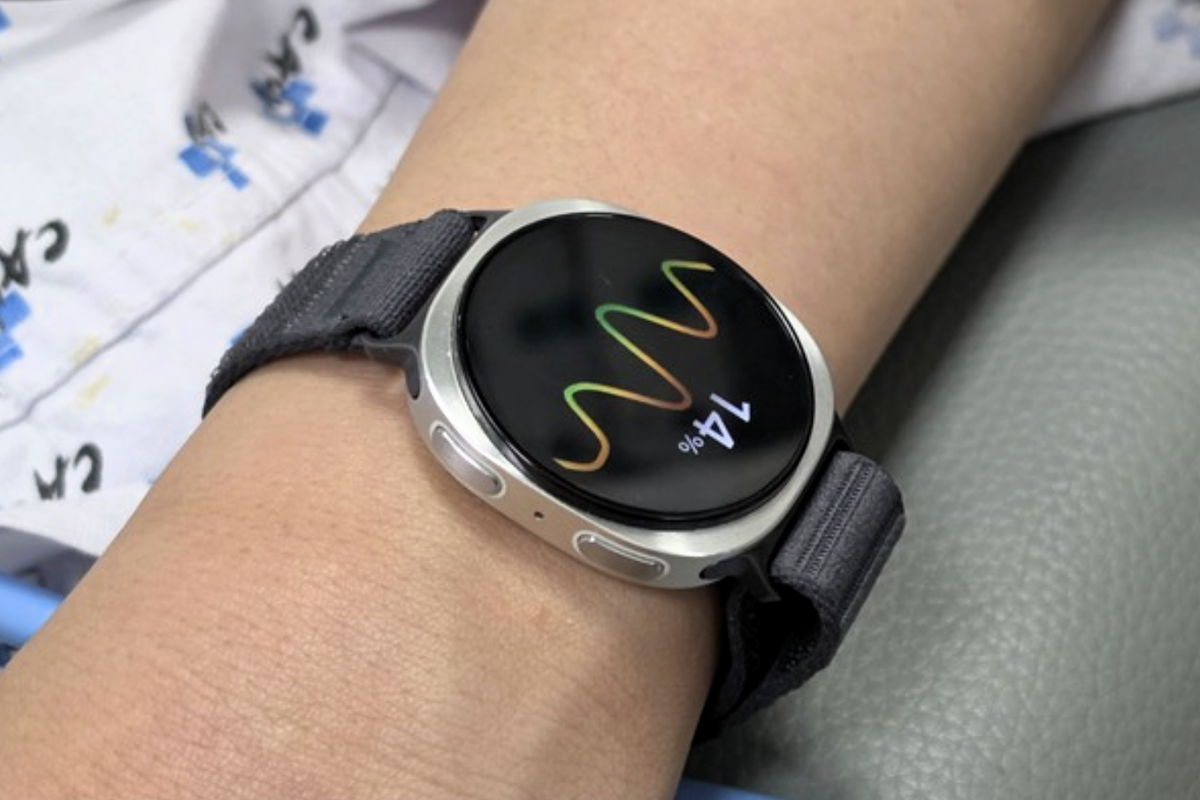 Your smartwatch can predict if you’re about to faint, research finds