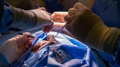 Florida surgeon charged after removing man’s liver instead of his spleen says he was ‘too upset’ to notice the difference
