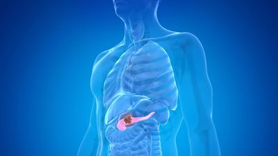 New AI model spots pancreatic cancer up to 3 years earlier than human doctors in test