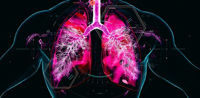 Chronic obstructive pulmonary disease develops over decades – and we are missing the window to prevent it
