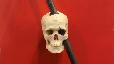 The Most Shocking Brain Injuries That Changed People Forever