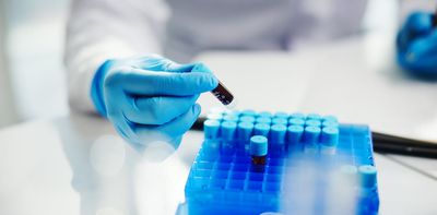 Africa has the world’s greatest genetic diversity, yet it’s missing from research: we’re filling the gap