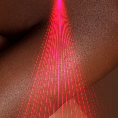How to Decide On the Best Laser for Melanin-Rich Skin—And Which to Avoid