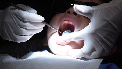 Thousands face tests over dentist HIV, hepatitis risks