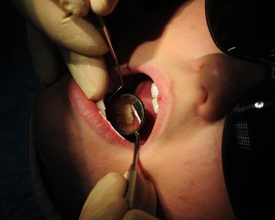 Health alert issued urging thousands of patients of retired Sydney dentist to get tested for HIV and hepatitis