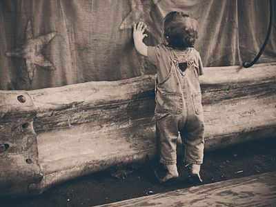 Impetigo Home Remedies Parents Can Use to Limit Contagion from Staphylococcus Among Kids