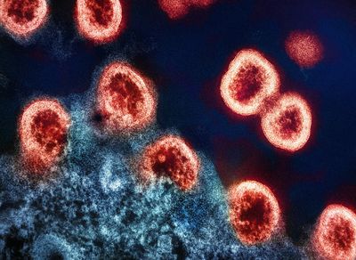 What Is Norovirus? Symptoms and Is It Deadly Explained After Cruise Outbreak Forces Emergency Passenger Disembarkation