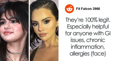 After Met Gala Frenzy Over Celebrity Bodies, Doctor Gives Verdict On The De‑Bloating Treatment Stars Get