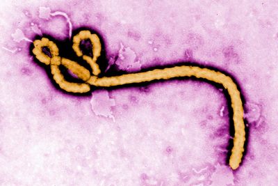 A look at major Ebola outbreaks and when the disease was first identified