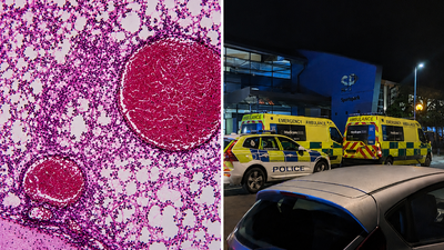 Meningitis outbreak sparks alarm after student dies and 2 others fall ill in Reading Area