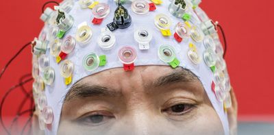 Brain implants allow us to move and talk. But they could also be hacked