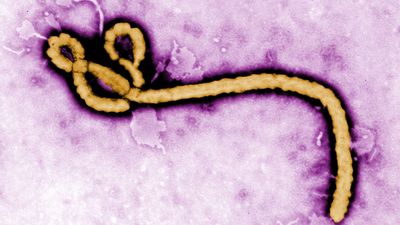 New Ebola Outbreak Kills 80 as WHO Declares a Public Health Emergency
