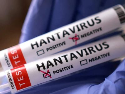 Hantavirus: Britain secures experimental Japanese drug to strengthen response