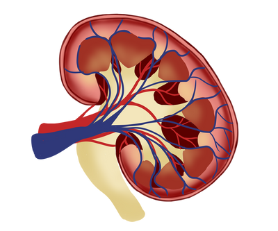 Nephrotic Syndrome Guide to Heavy Proteinuria Edema, Foamy Urine, and Hidden Kidney Risk