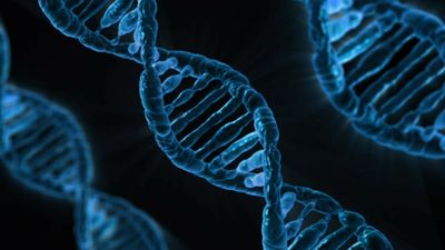 Hereditary Hemochromatosis and HFE Gene Mutation Causing Silent Iron Overload and Liver and Heart Damage
