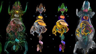 New AI atlas reveals how obesity affects the entire body