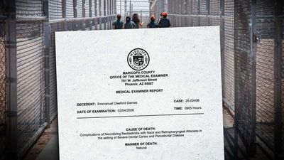 An ICE Detainee Died from a Tooth Infection, Autopsy Report Says
