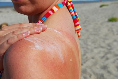 Melanoma skin cancer cases hit record high in the UK as heatwave warning issued