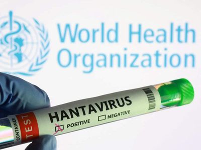 Hantavirus outbreak: How an African lab identified the deadly Andes strain