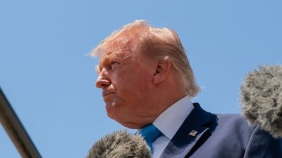 Donald Trump’s war on baldness ends in defeat, scalp finally waves white flag