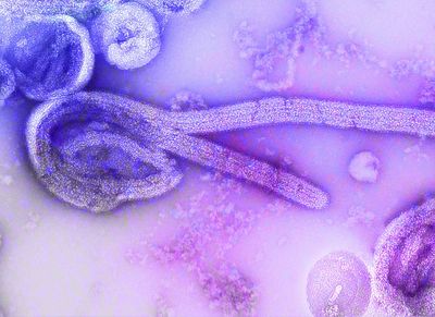 Why Ebola Continues to Spread in DR Congo Despite Years of Outbreak Response