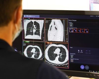 NHS spends record £241m outsourcing scan analysis to private firms