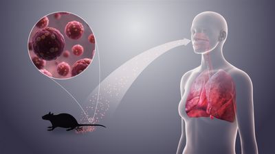 Hantavirus Explodes Across US Northwest: High Levels of Lung-Damaging Sin Nombre Virus Detected