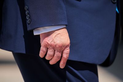 Almost 80, Trump renews health scrutiny